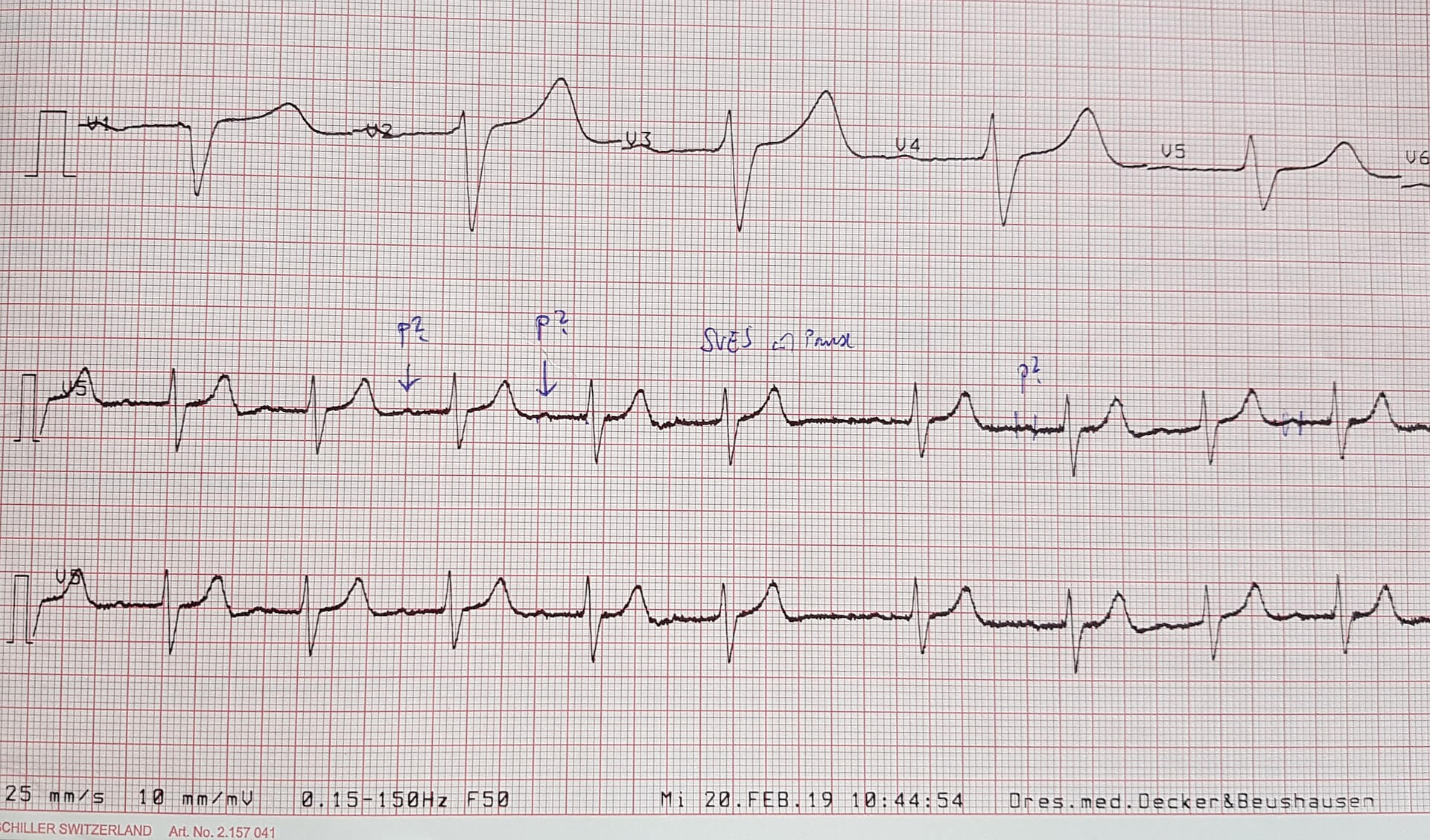 Electrocardiogram